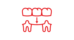 Crowns & Bridges Crowns & Bridges