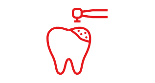 Inlays & Onlays Inlays & Onlays