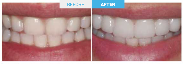 Group 1796 Before and after