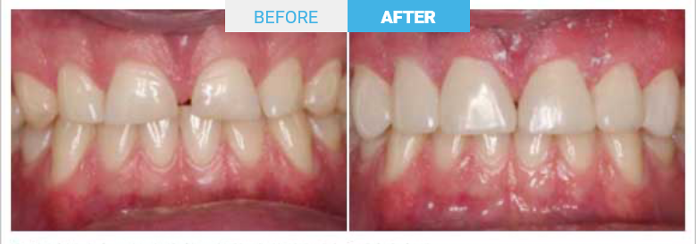 Group 1798 Before and after