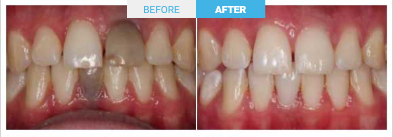 Group 1800 Before and after