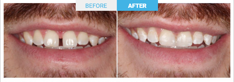 Group 1801 Before and after