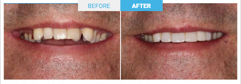 Group 1805 Before and after