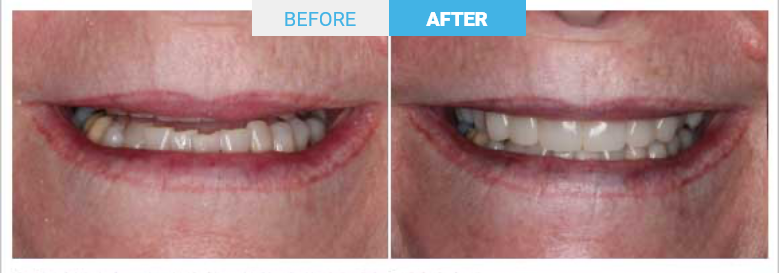 Group 1806 Before and after