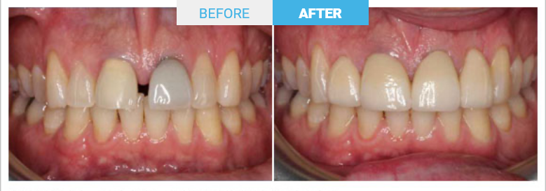 Group 1807 Before and after