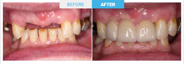 Group 1808 Before and after