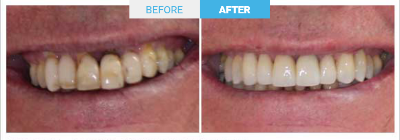 Group 1809 Before and after