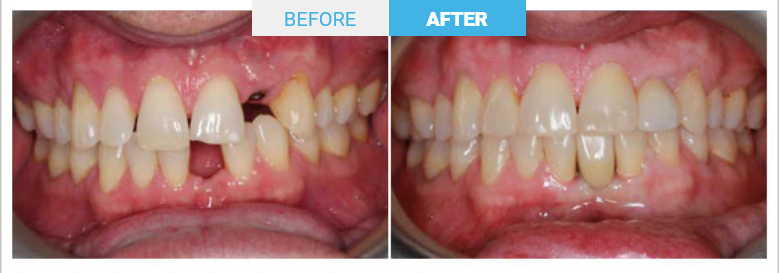 Group 1810 Before and after
