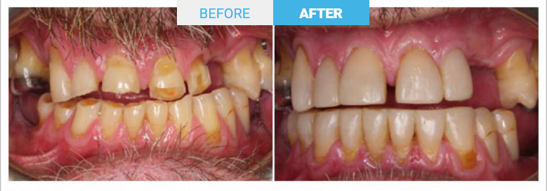 Group 1816 Before and after