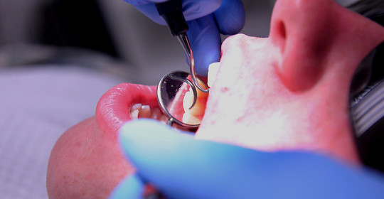 Using mirror for dental operations