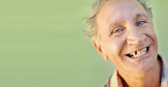 dental implants complete smile