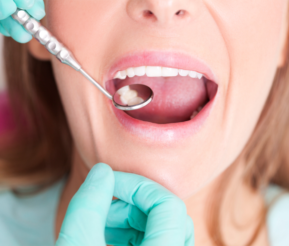 iStock-514771081 Fissure Sealants