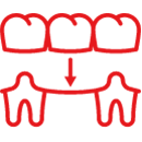 Crowns & Bridges Crowns & Bridges