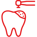 Inlays & Onlays Inlays & Onlays